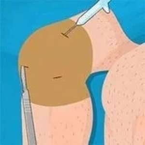 Joint Repair Clinic: Precision Surgery